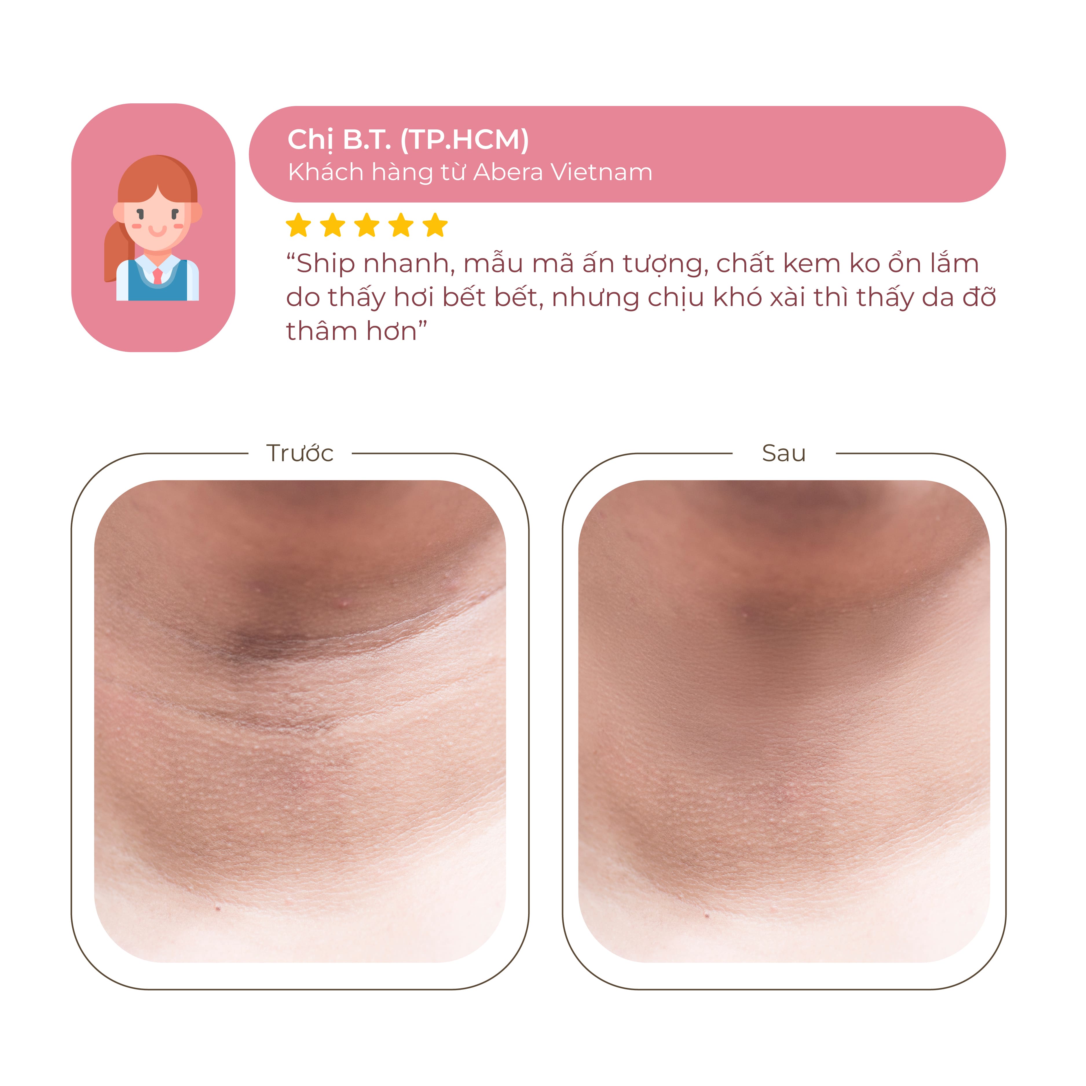 Kem Mờ Thâm Thảo Dược Abera